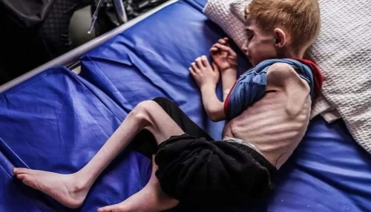 Gazze'ye Girişi Engellenen Binlerce Yardım Tırı Varken Çocukların Açlıktan Ölmesi Savaş Suçudur